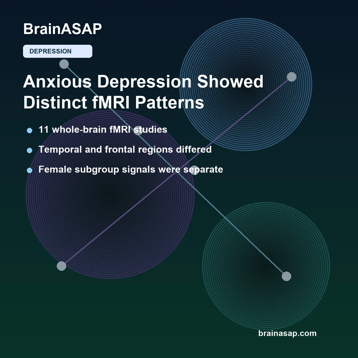 Anxious Depression Showed Distinct Whole-Brain fMRI Patterns