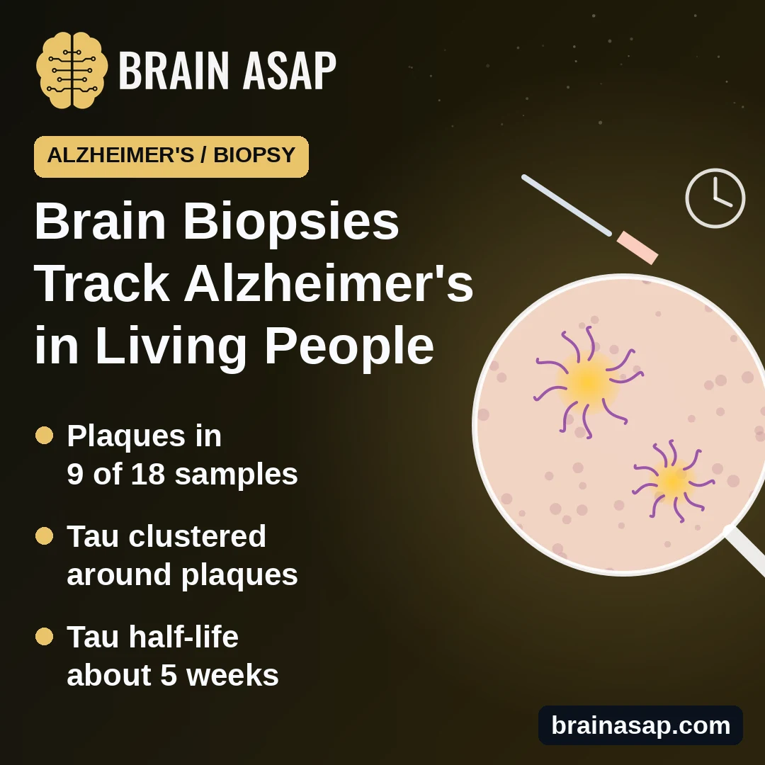 Tiny Brain Biopsies Track Alzheimer’s Changes in Living People