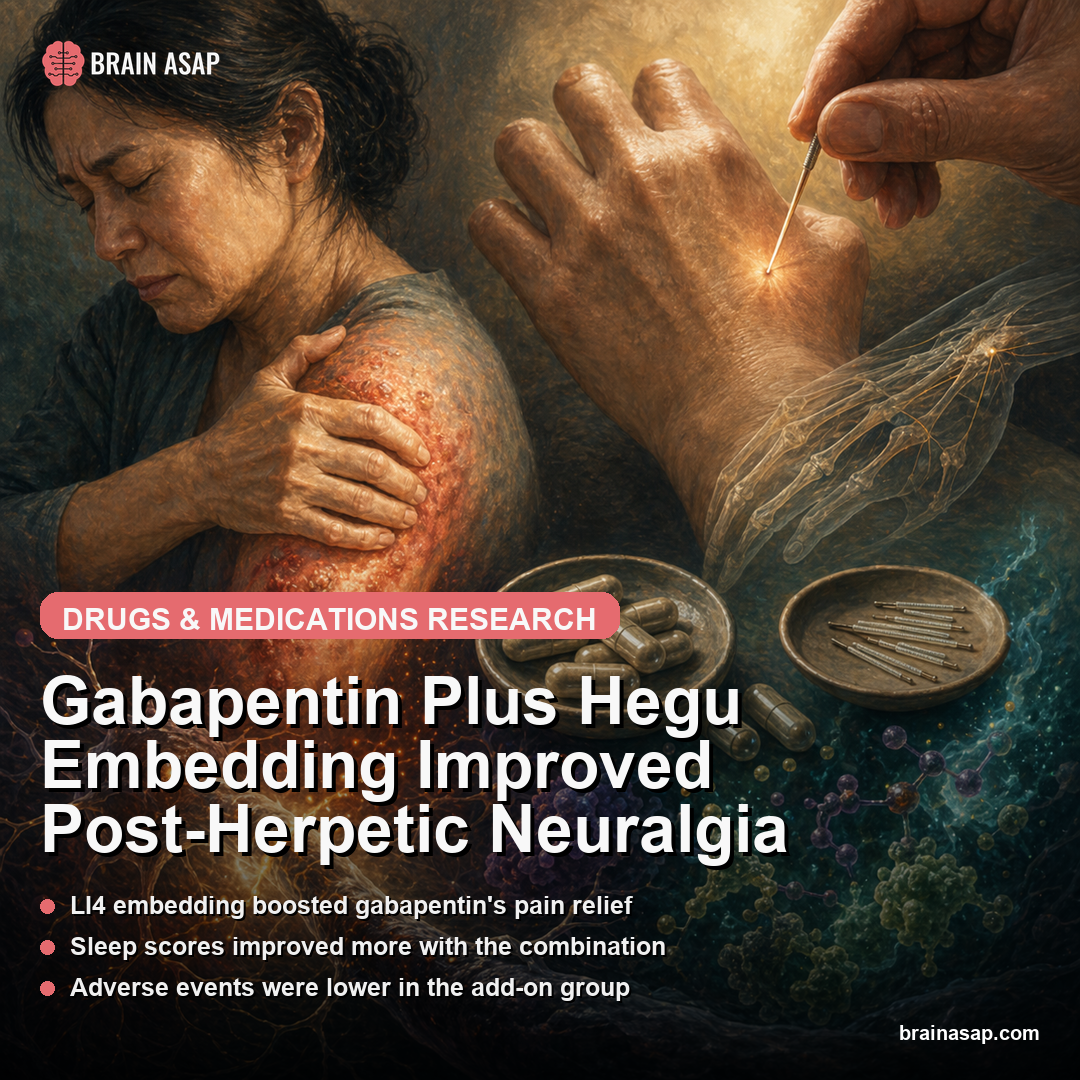 Gabapentin Plus Hegu Embedding Improved Post-Herpetic Neuralgia