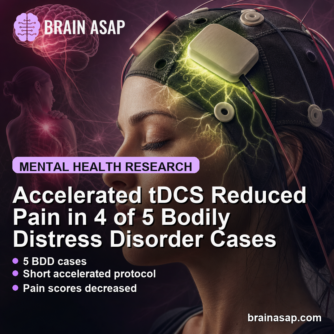 Accelerated tDCS Reduced Pain in 4 of 5 Bodily Distress Disorder Cases
