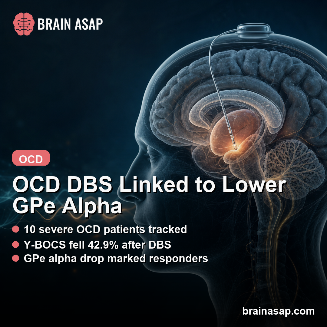 OCD DBS Response Linked to Lower GPe Alpha-Band Activity