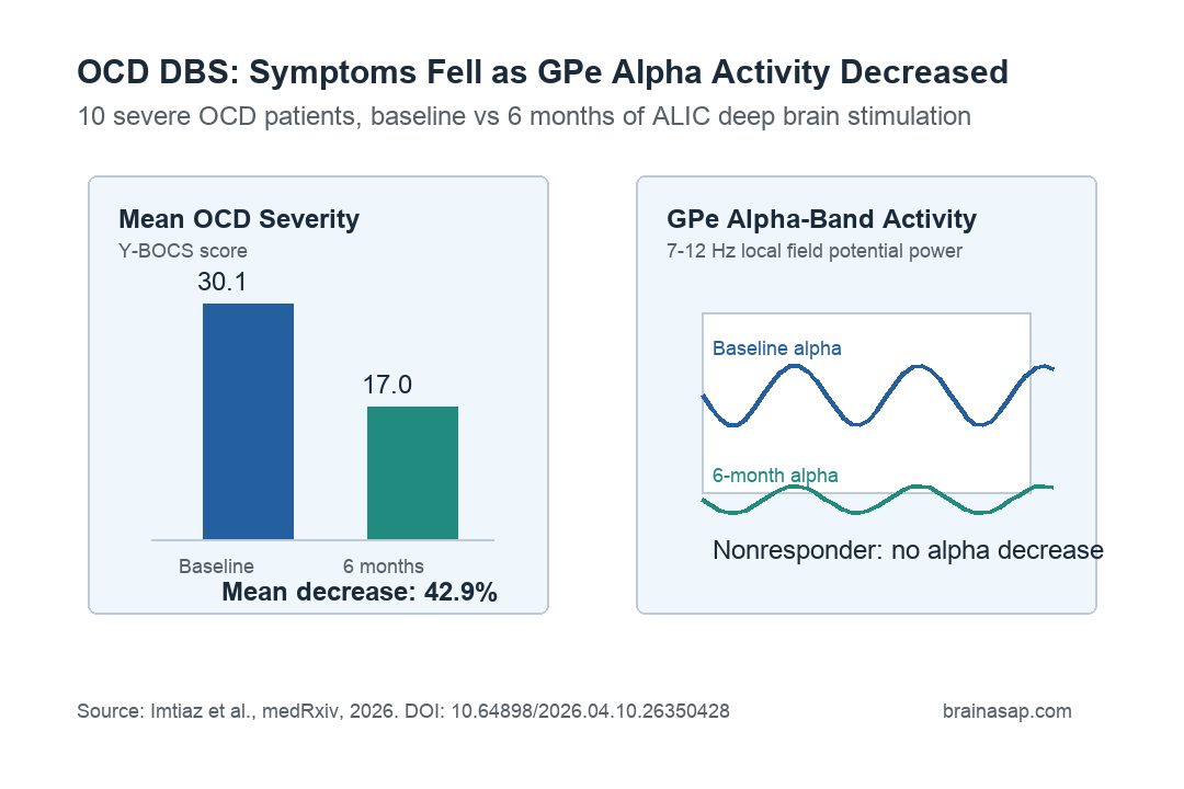 Summary chart showing OCD symptom score decrease and GPe alpha activity decrease after 6 months of DBS