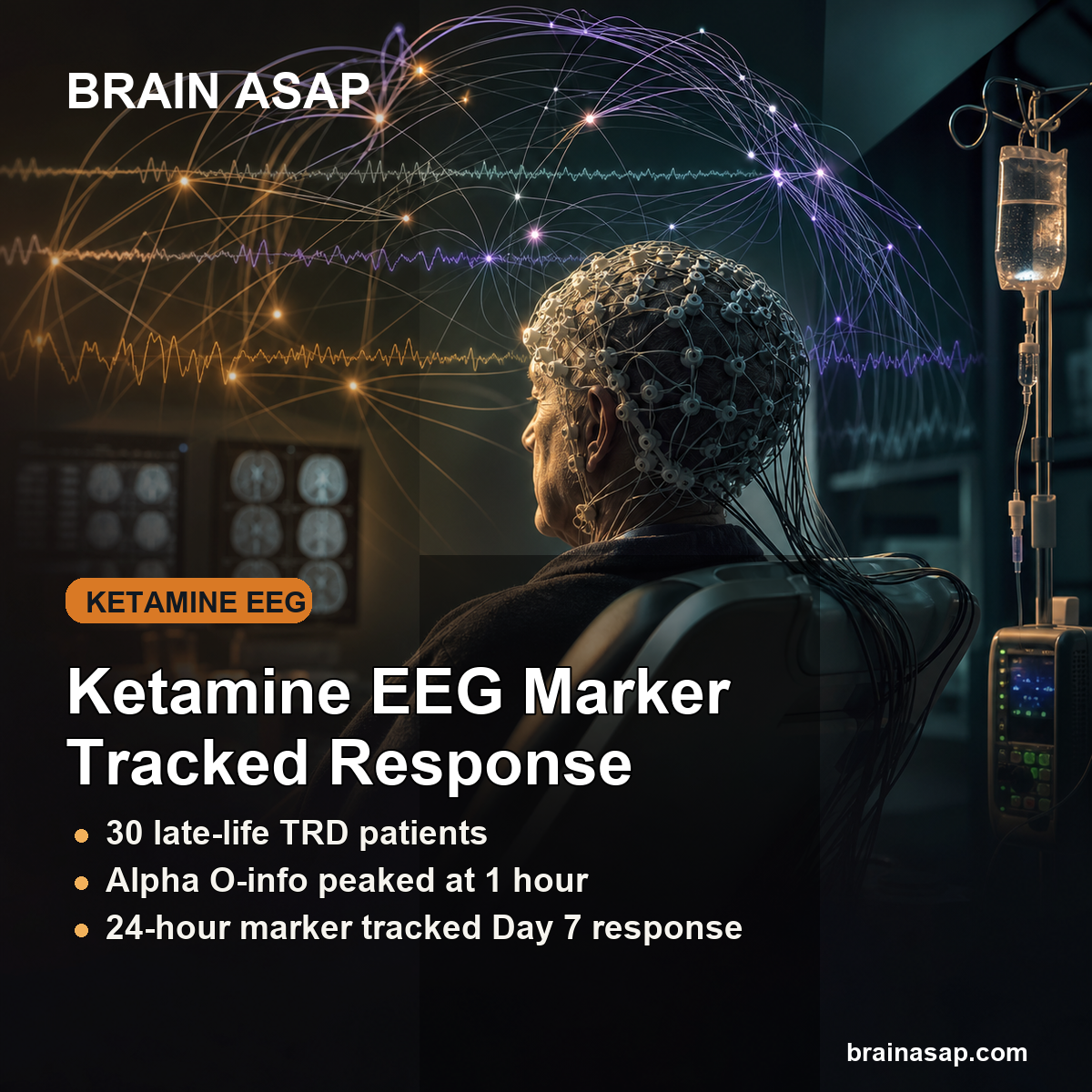 Ketamine EEG Alpha Redundancy Tracked Depression Response in Late-Life TRD