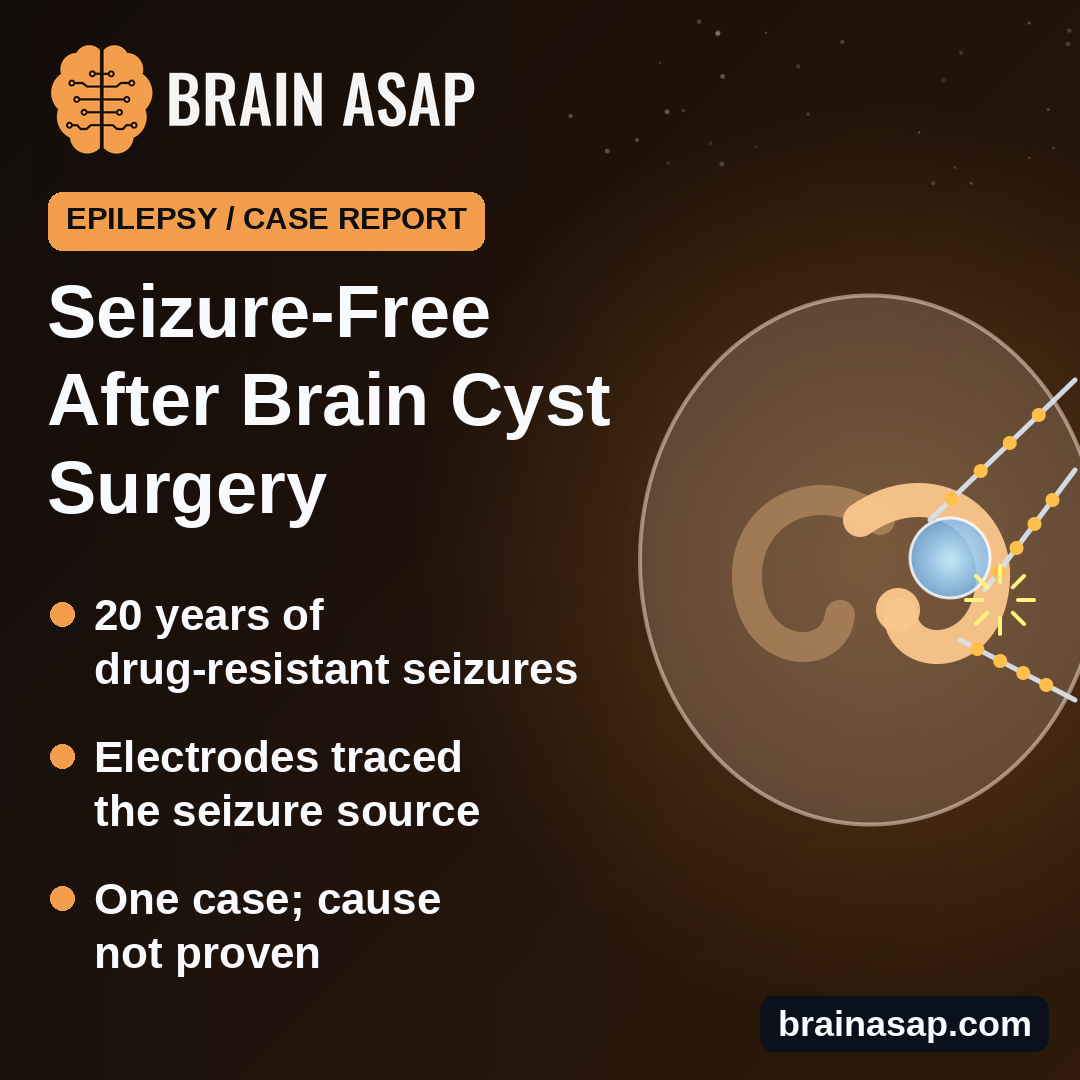 Woman Seizure-Free After Brain Cyst Surgery