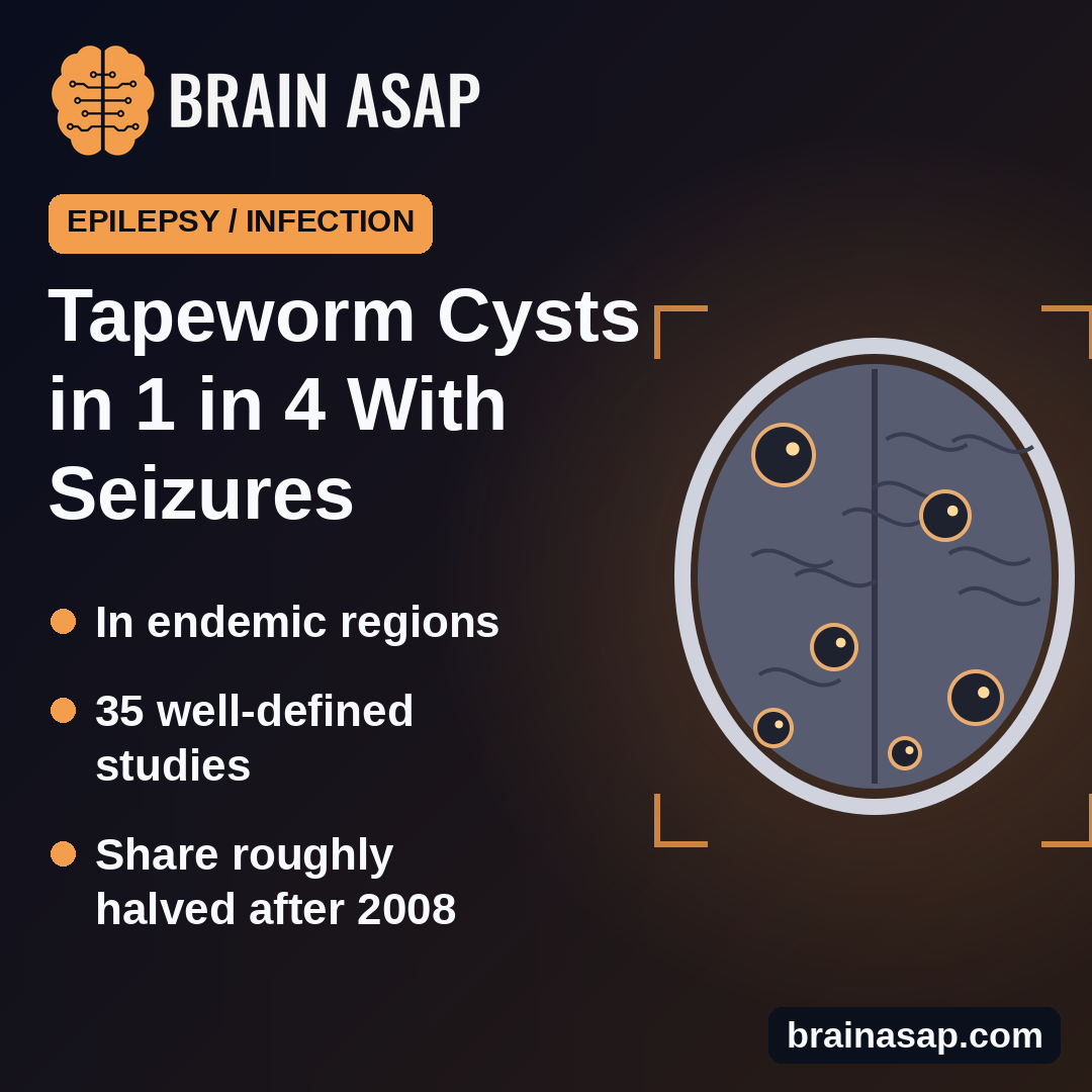Tapeworm Brain Cysts Found in About 1 in 4 People With Seizures Where the Parasite Is Common